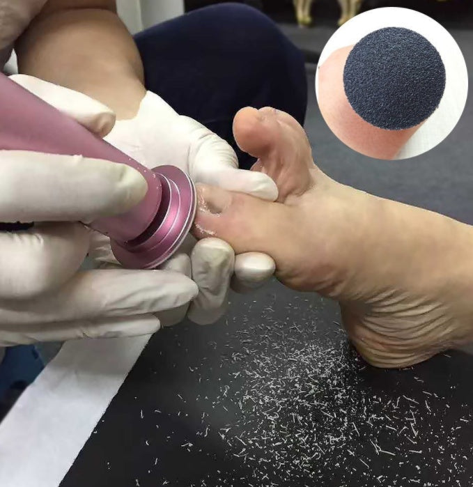 Lima eléctrica profesional para pedicura – Eliminación de durezas y callos con rotación 360°